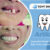 rony-dental-spesialis-pembuatan-gigi-palsu. - 1