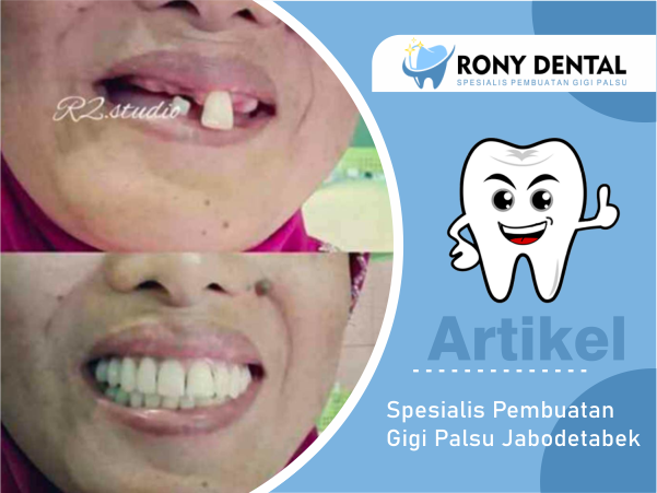 rony-dental-spesialis-pembuatan-gigi-palsu. - 1