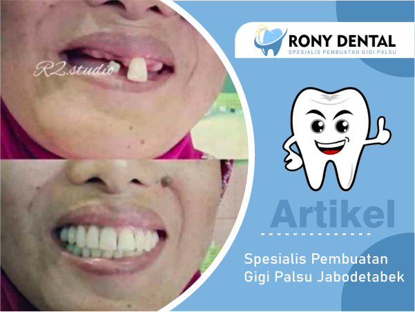 rony-dental-spesialis-pembuatan-gigi-palsu. - 1