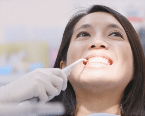 rony dental - veneer gigi