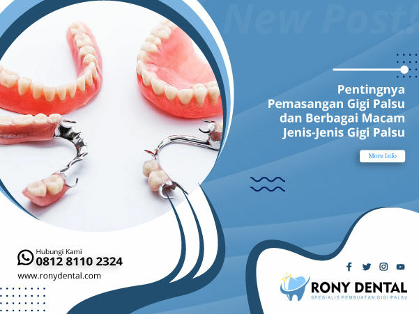 Pentingnya-Pemasangan-Gigi-Palsu-dan-Berbagai-Macam-Jenis-Jenis-Gigi-Palsu